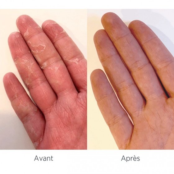 Avant/après gants de soin MÊME